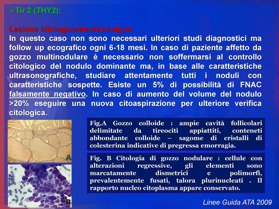 tutti i noduli con caratteristiche sospette. Esiste un 5% di possibilità di FNAC falsamente negativo.