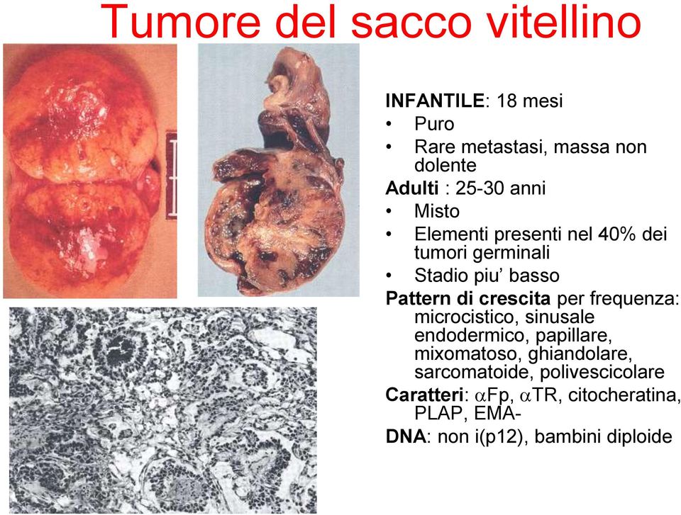 crescita per frequenza: microcistico, sinusale endodermico, papillare, mixomatoso, ghiandolare,