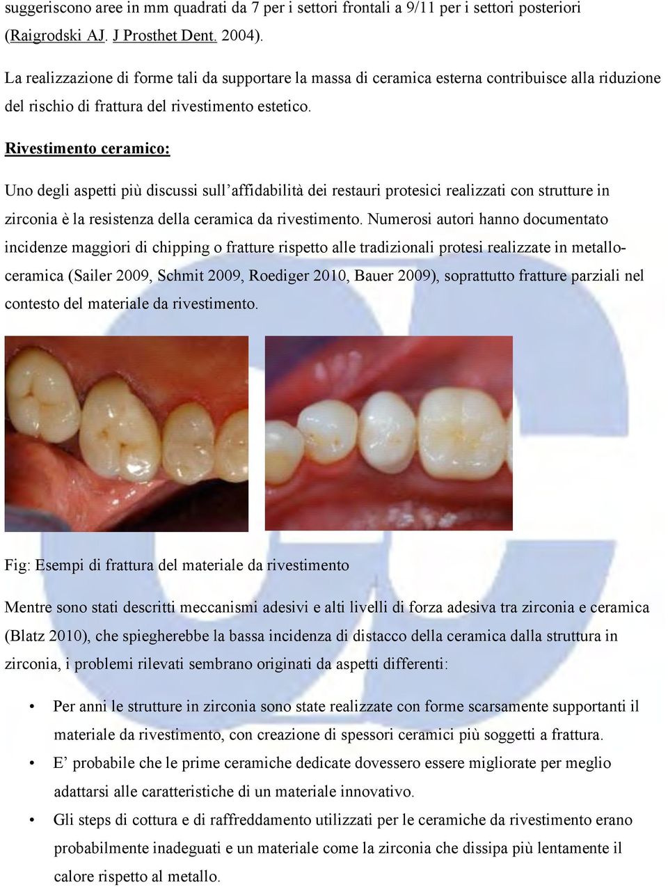 Rivestimento ceramico: Uno degli aspetti più discussi sull affidabilità dei restauri protesici realizzati con strutture in zirconia è la resistenza della ceramica da rivestimento.