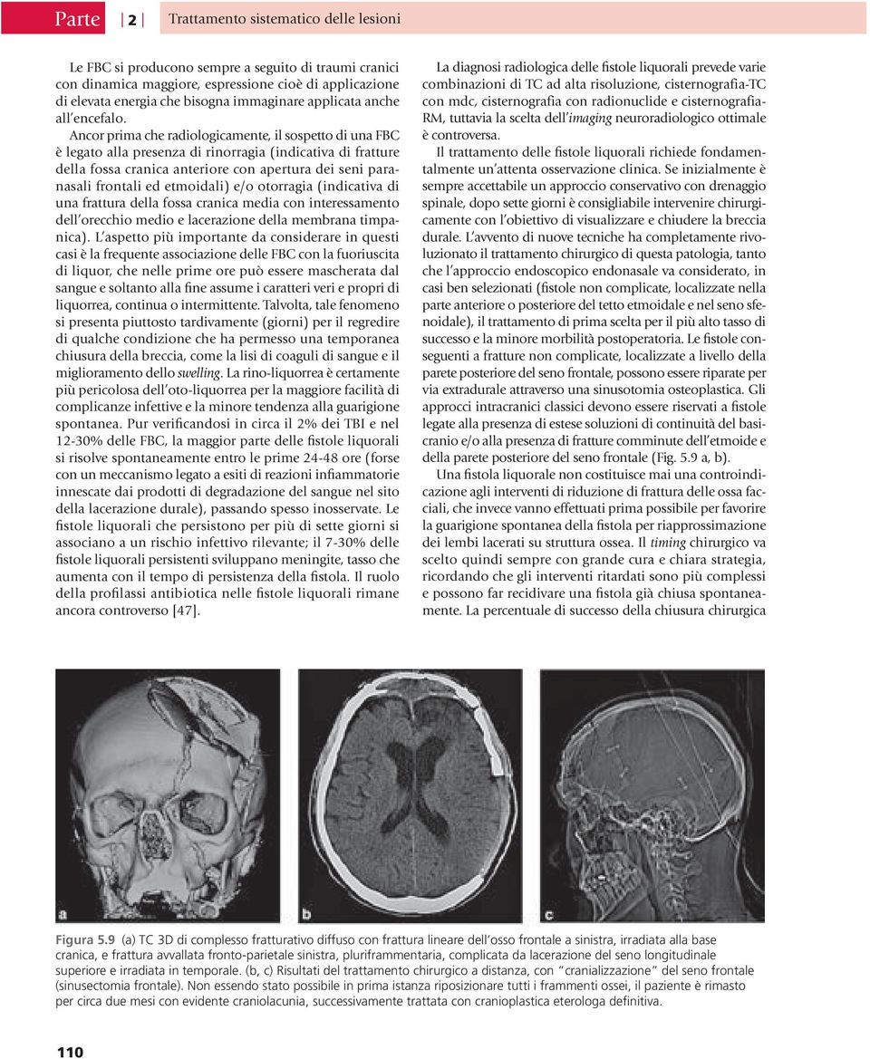 Ancor prima che radiologicamente, il sospetto di una FBC è legato alla presenza di rinorragia (indicativa di fratture della fossa cranica anteriore con apertura dei seni paranasali frontali ed