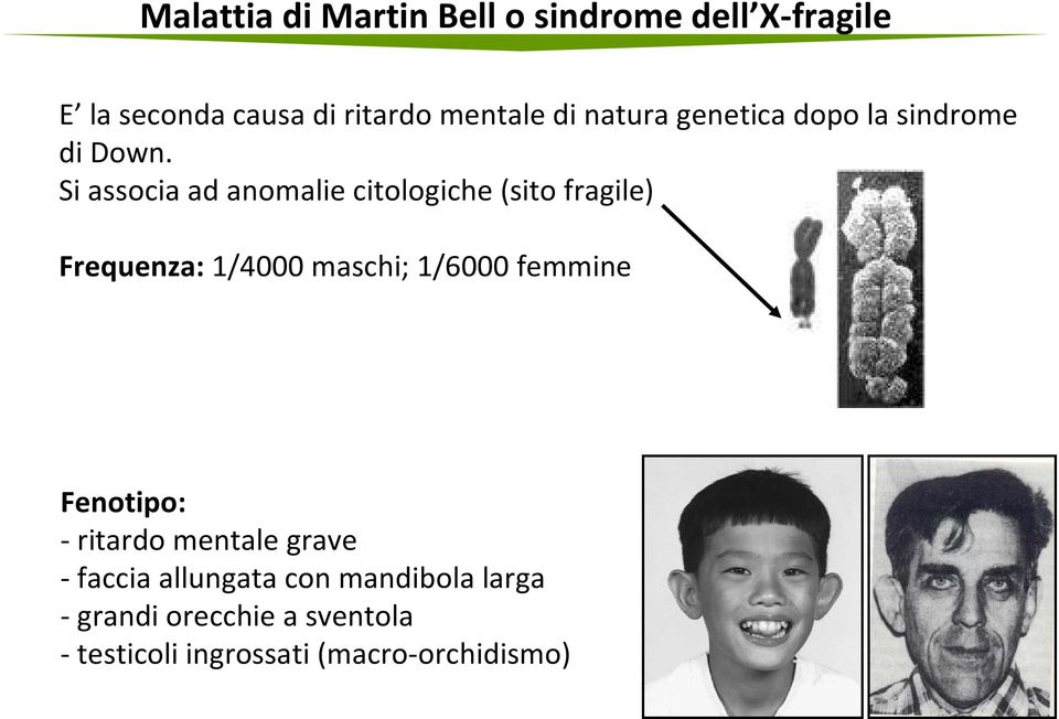 Si associa ad anomalie citologiche (sito fragile) Frequenza: 1/4000 maschi; 1/6000 femmine