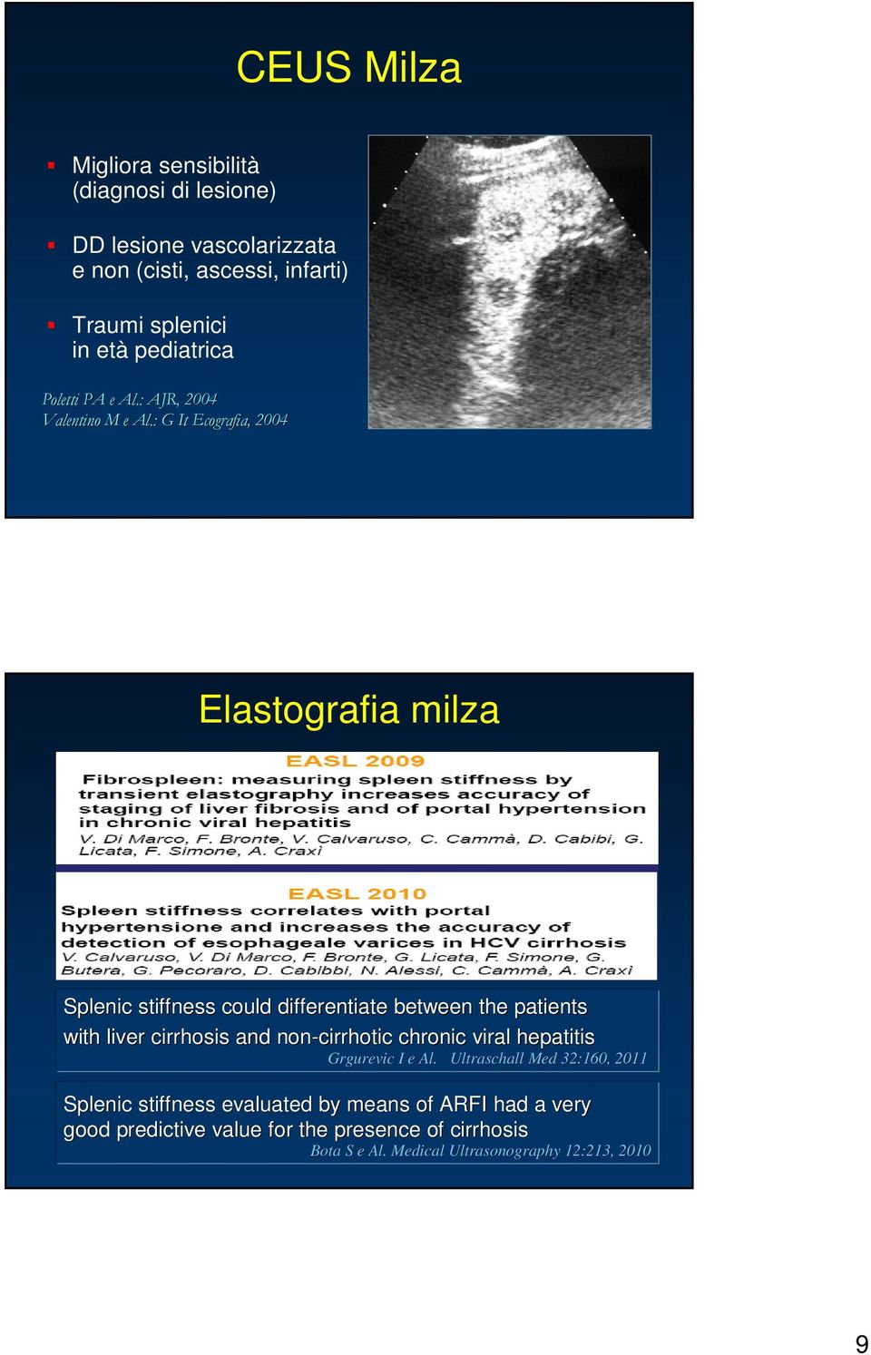 : G It Ecografia, 2004 Elastografia milza Splenic stiffness could differentiate between the patients with liver cirrhosis and non-cirrhotic