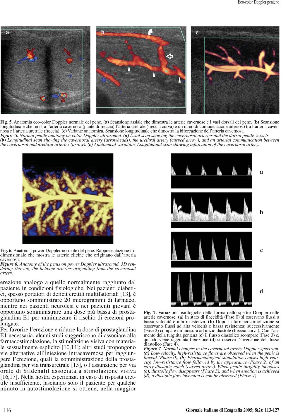 (freccia). (c) Variante anatomica. Scansione longitudinale che dimostra la biforcazione dell arteria cavernosa. Figure 5. Normal penile anatomy on color Doppler ultrasound.