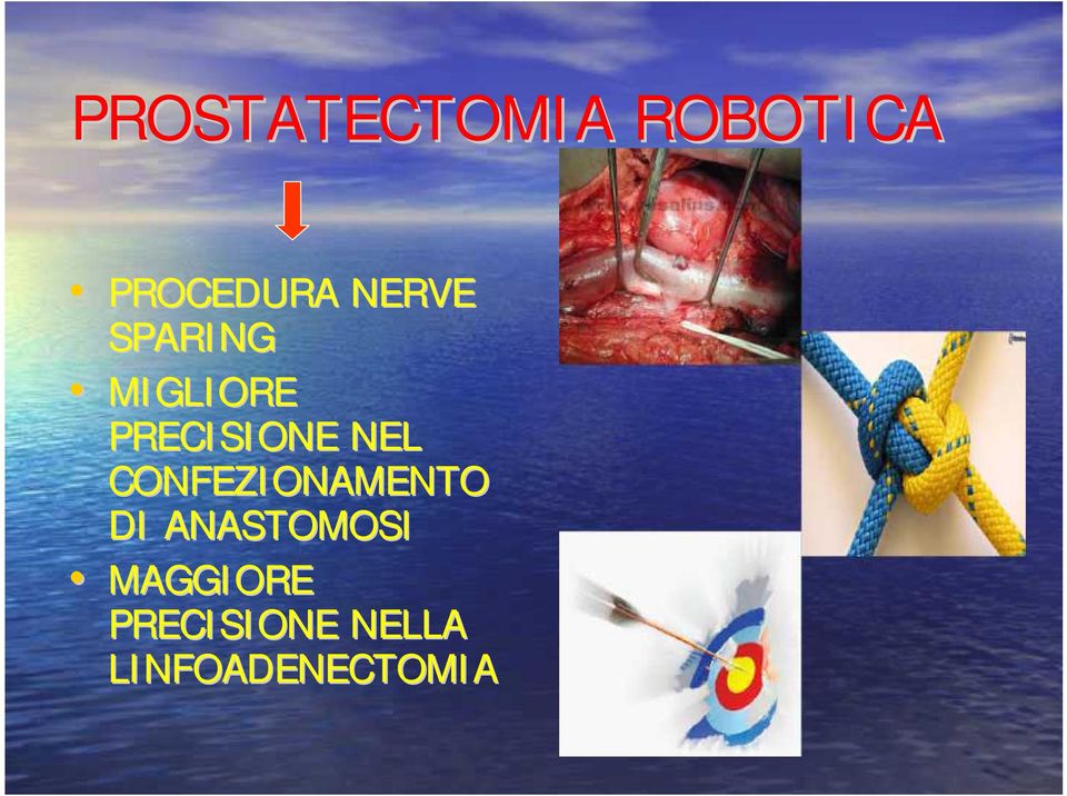 NEL CONFEZIONAMENTO DI ANASTOMOSI