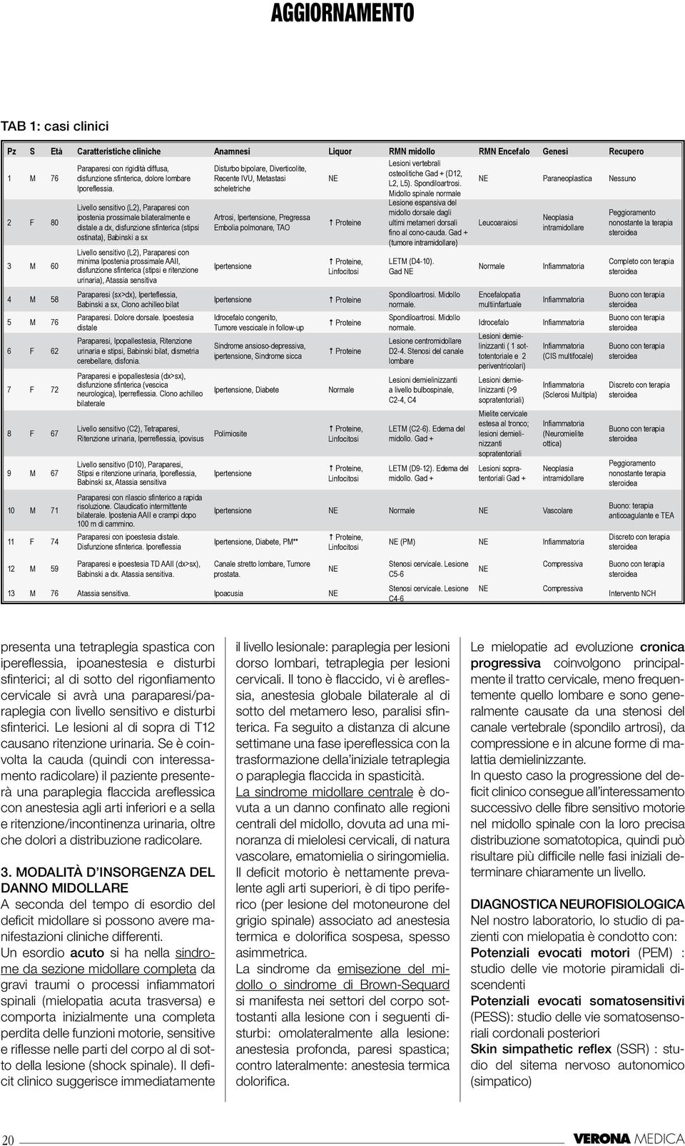 Livello sensitivo (L2), Paraparesi con ipostenia prossimale bilateralmente e distale a dx, disfunzione sfinterica (stipsi ostinata), Babinski a sx Livello sensitivo (L2), Paraparesi con minima