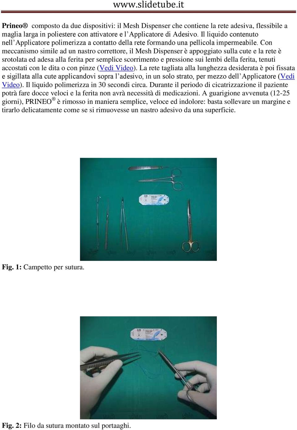 Con meccanismo simile ad un nastro correttore, il Mesh Dispenser è appoggiato sulla cute e la rete è srotolata ed adesa alla ferita per semplice scorrimento e pressione sui lembi della ferita, tenuti