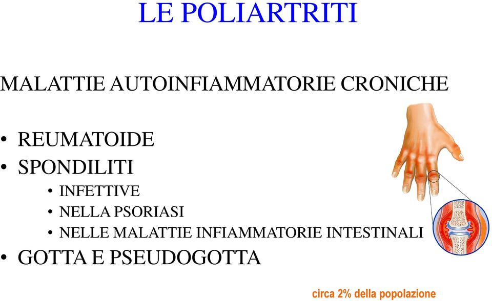 PSORIASI NELLE MALATTIE INFIAMMATORIE