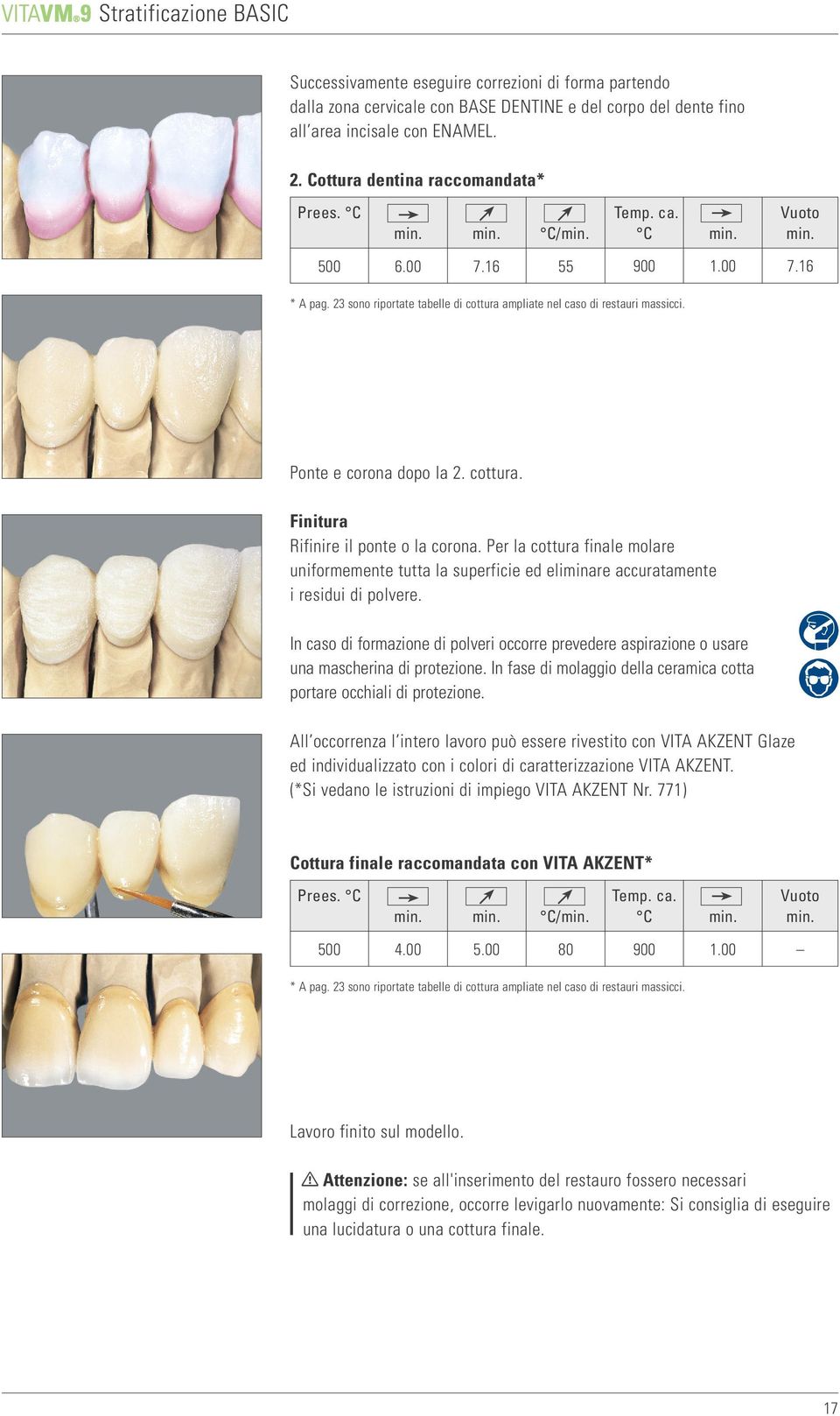 cottura. Finitura Rifinire il ponte o la corona. Per la cottura finale molare uniformemente tutta la superficie ed eliminare accuratamente i residui di polvere.