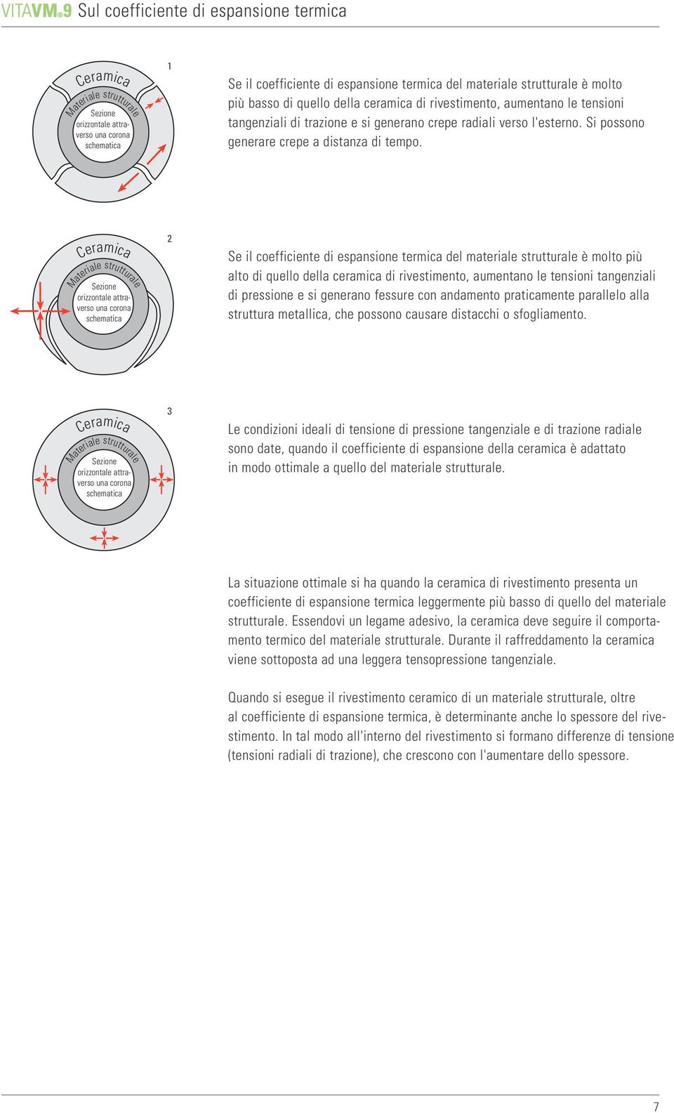 Ceramica Materiale strutturale Sezione orizzontale attraverso una corona schematica 2 Se il coefficiente di espansione termica del materiale strutturale è molto più alto di quello della ceramica di