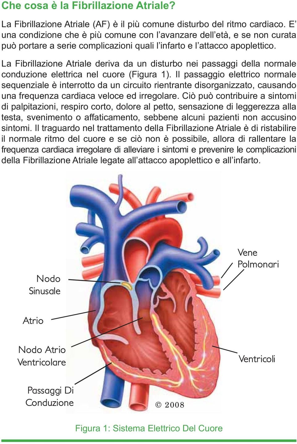 La Fibrillazione Atriale deriva da un disturbo nei passaggi della normale conduzione elettrica nel cuore (Figura 1).