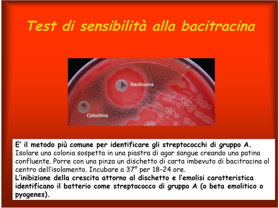 Porre con una pinza un dischetto di carta imbevuto di bacitracina al centro dell isolamento. Incubare a 37 per 18-24 ore.