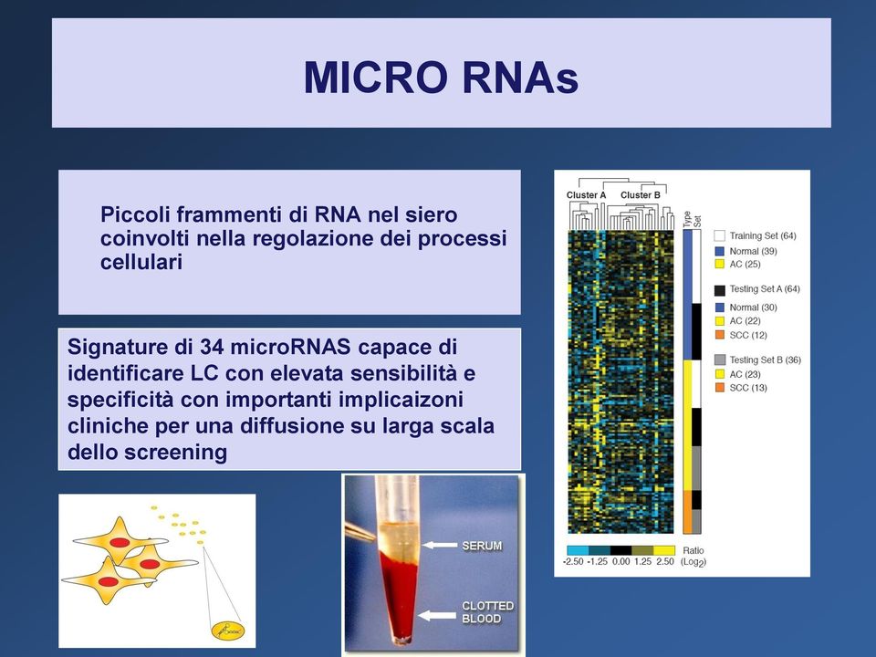 di identificare LC con elevata sensibilità e specificità con