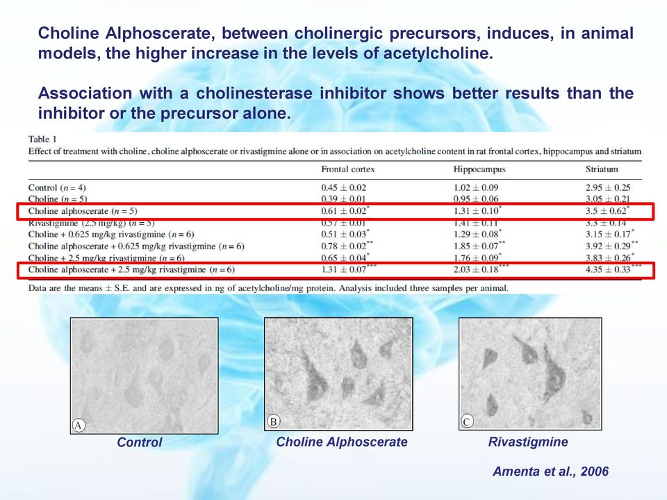 Association with a cholinesterase inhibitor shows better results than the