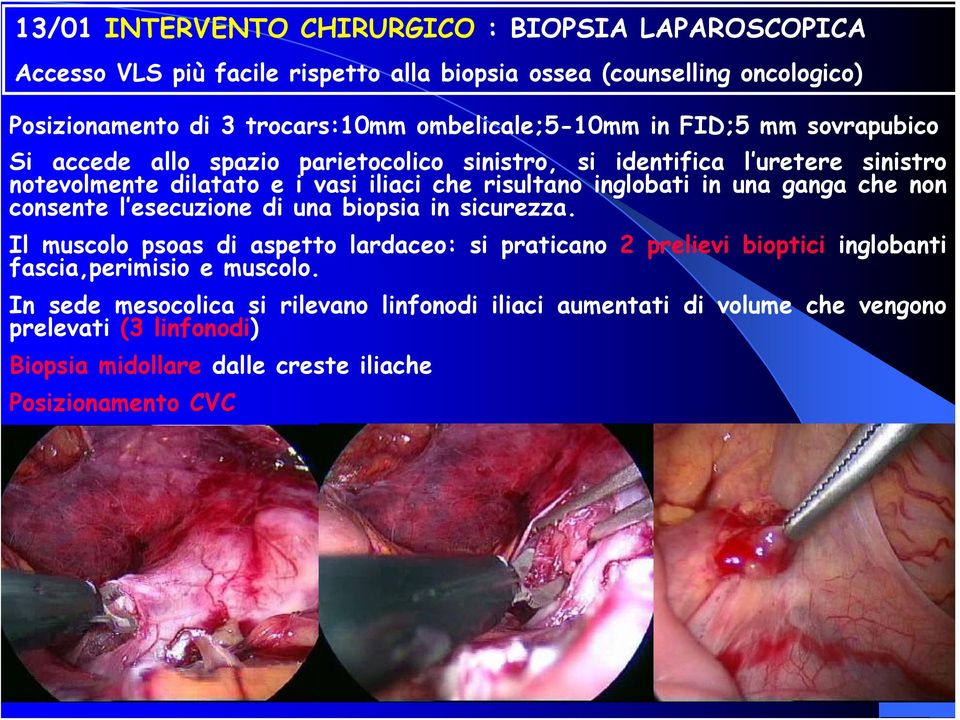 risultano inglobati in una ganga che non consente l esecuzione di una biopsia in sicurezza.