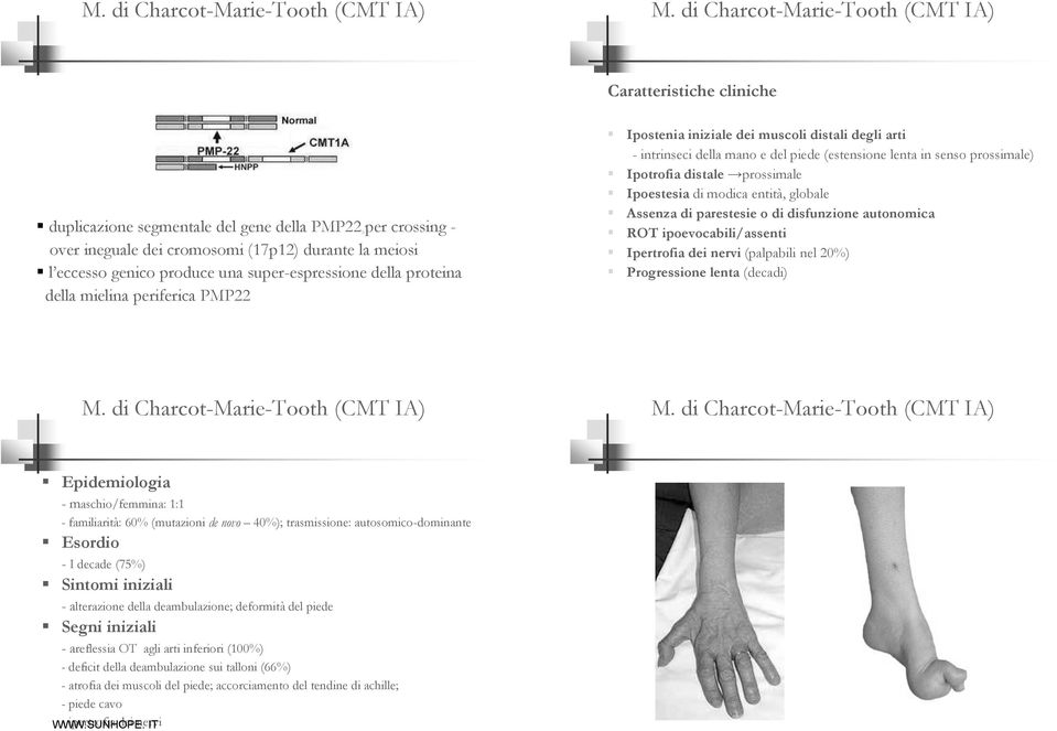 super-espressione della proteina della mielina periferica PMP22 Ipostenia iniziale dei muscoli distali degli arti - intrinseci della mano e del piede (estensione lenta in senso prossimale) Ipotrofia