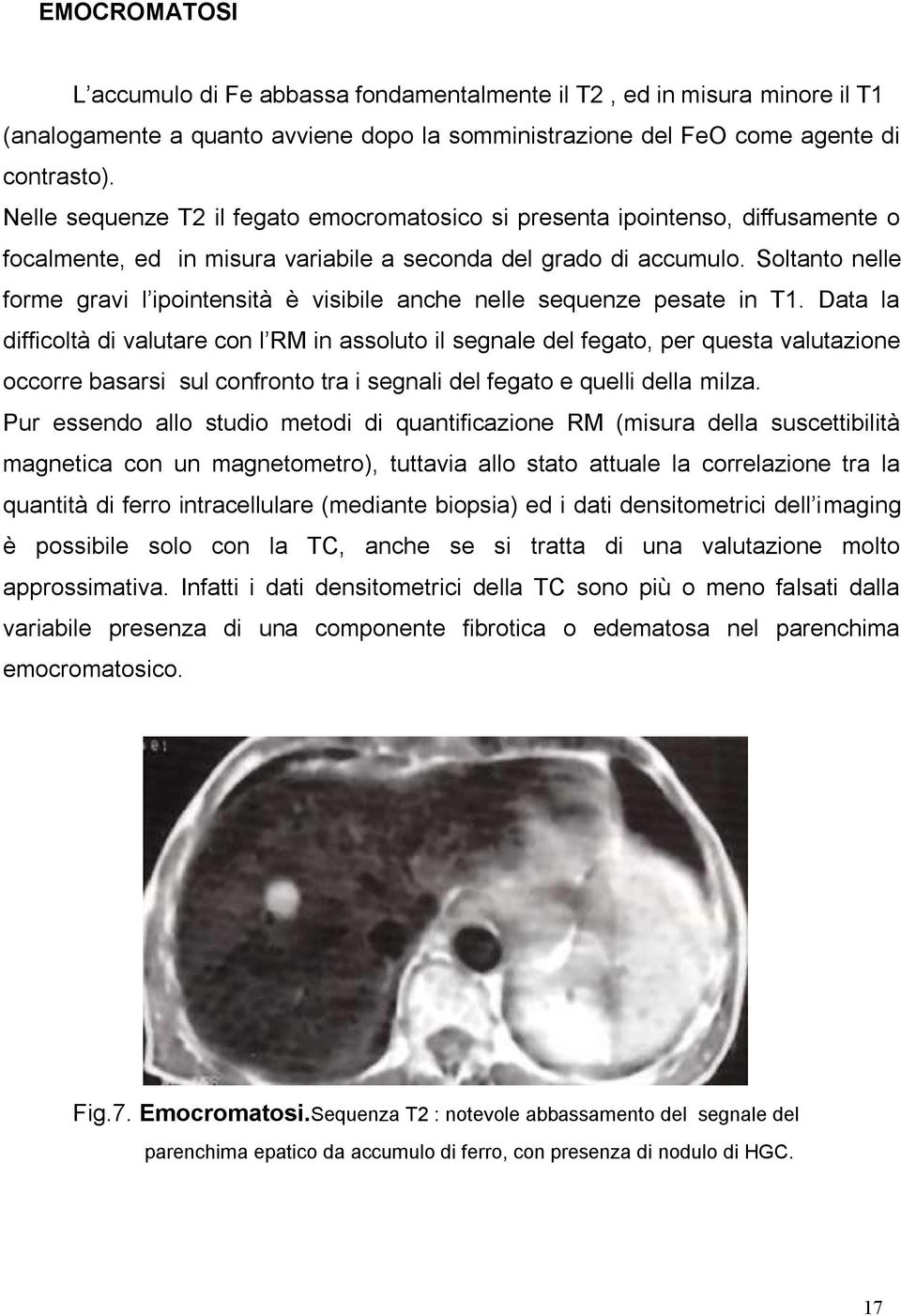 Soltanto nelle forme gravi l ipointensità è visibile anche nelle sequenze pesate in T1.