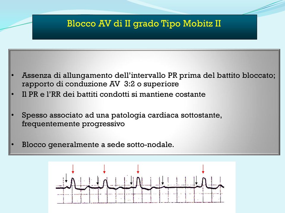 RR dei battiti condotti si mantiene costante Spesso associato ad una patologia