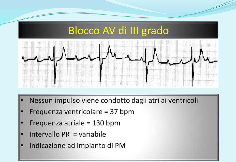 bpm Frequenza atriale = 130 bpm Intervallo