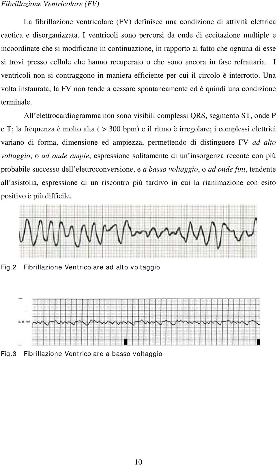 che sono ancora in fase refrattaria. I ventricoli non si contraggono in maniera efficiente per cui il circolo è interrotto.