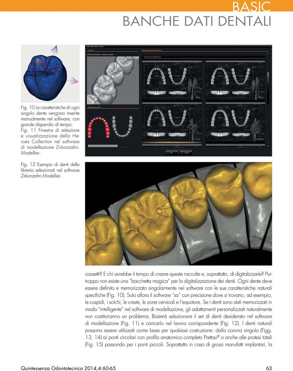 Modellier. cassetti? E chi avrebbe il tempo di creare queste raccolte e, soprattutto, di digitalizzarle? Purtroppo non esiste una bacchetta magica per la digitalizzazione dei denti.