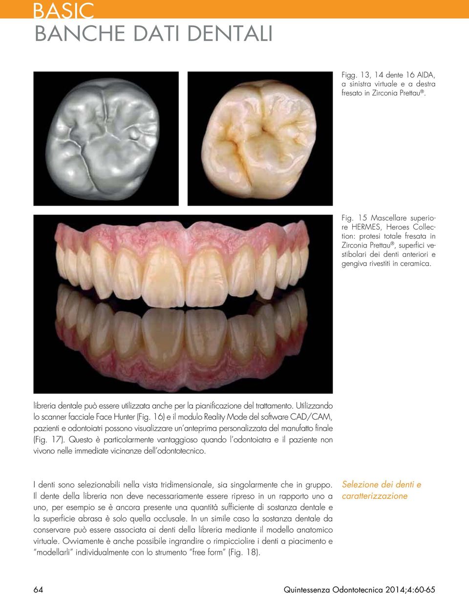 libreria dentale può essere utilizzata anche per la pianificazione del trattamento. Utilizzando lo scanner facciale Face Hunter (Fig.