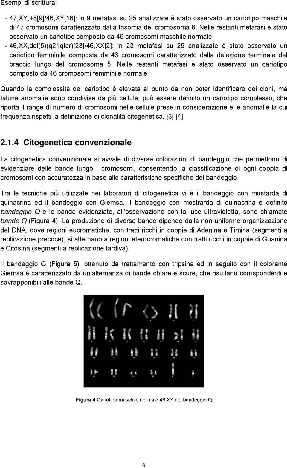 femminile composta da 46 cromosomi caratterizzato dalla delezione terminale del braccio lungo del cromosoma 5.