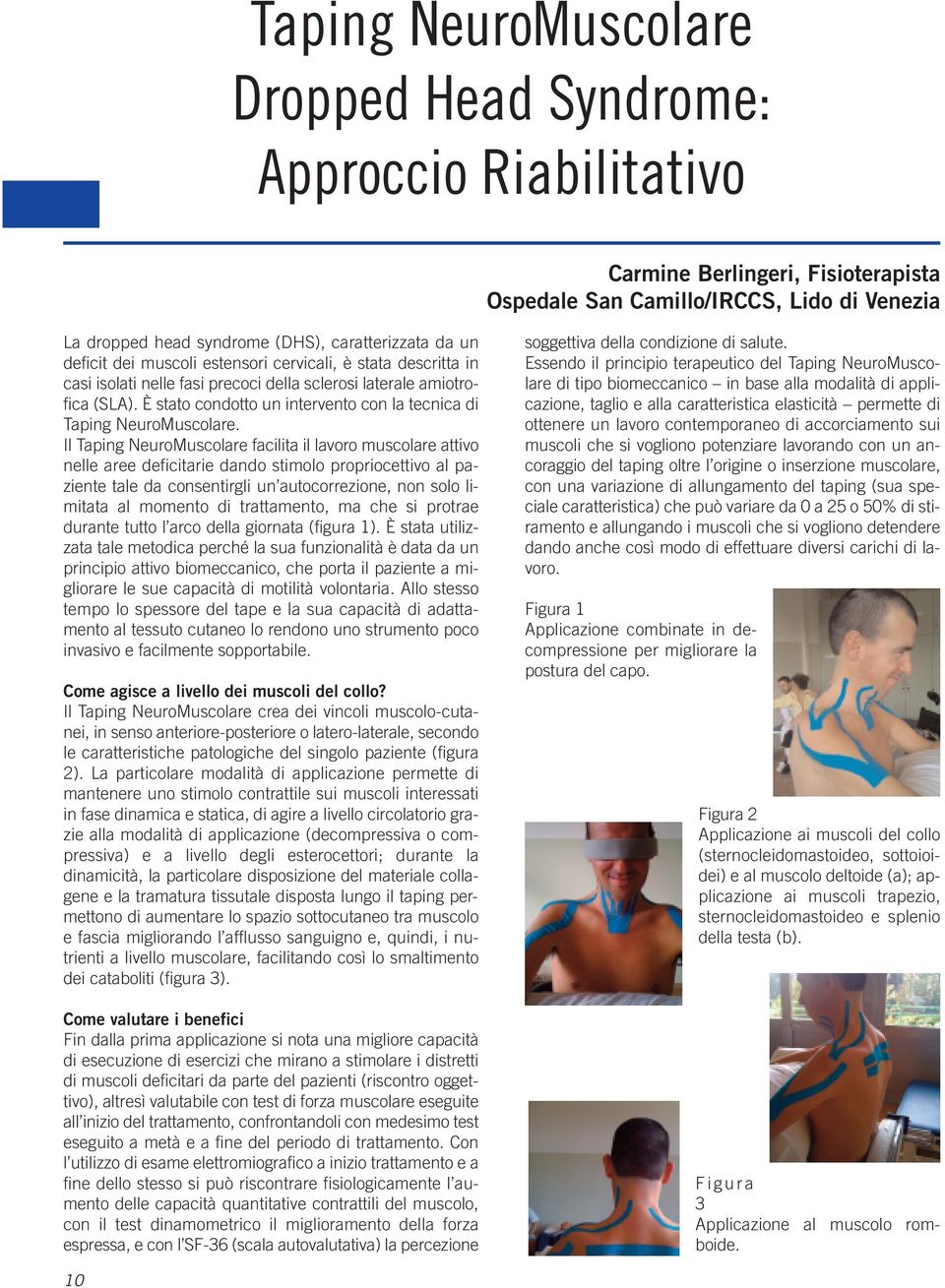 È stato condotto un intervento con la tecnica di Taping NeuroMuscolare.