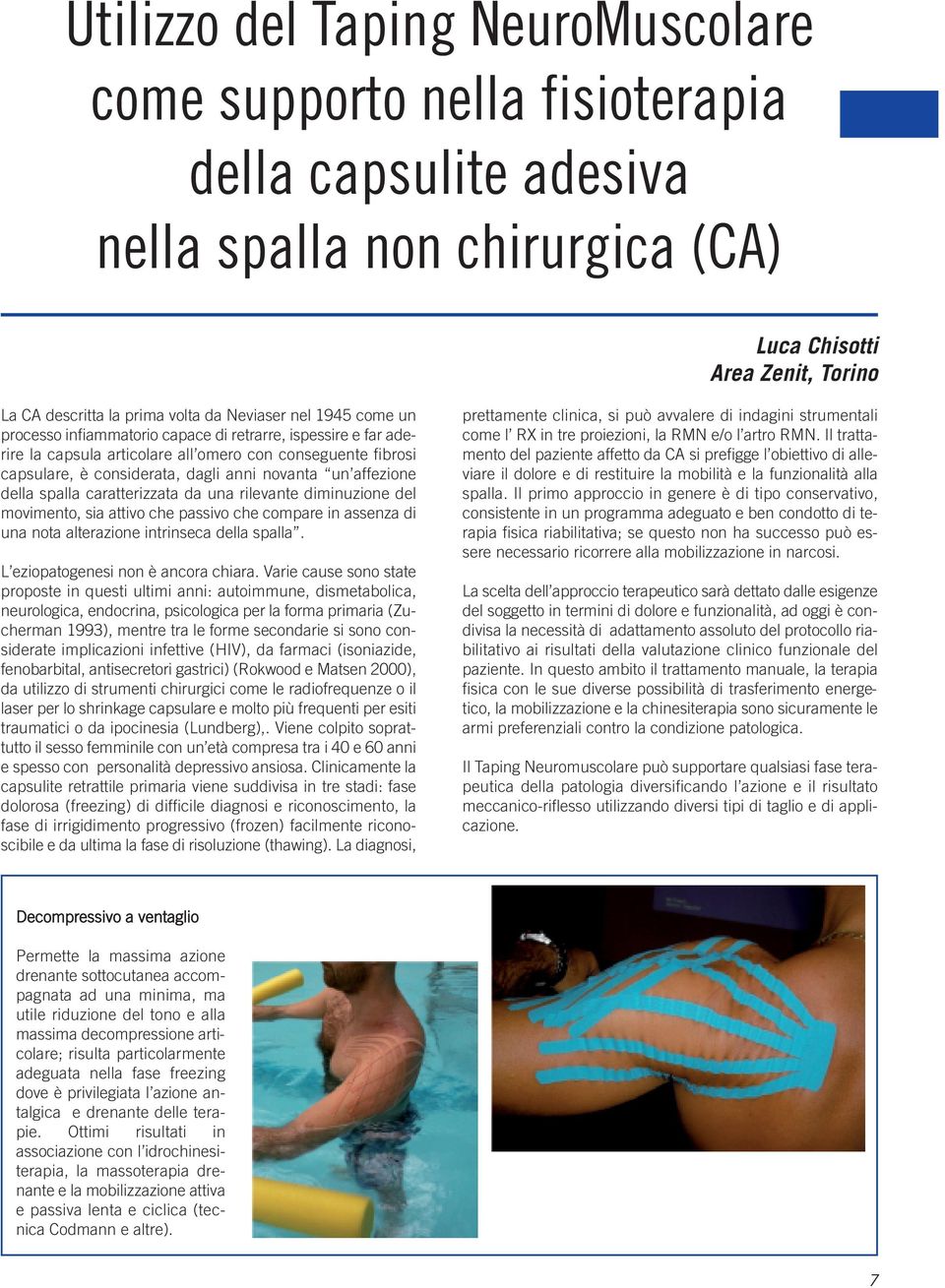 affezione della spalla caratterizzata da una rilevante diminuzione del movimento, sia attivo che passivo che compare in assenza di una nota alterazione intrinseca della spalla.