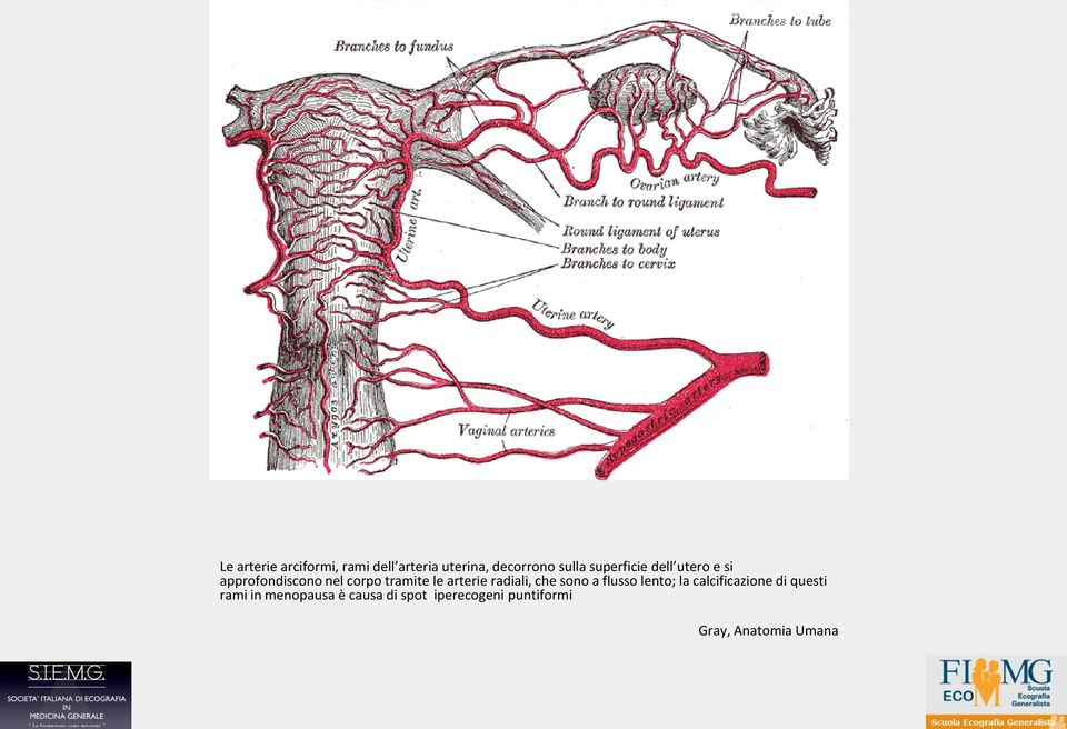 arterie radiali, che sono a flusso lento; la calcificazione di