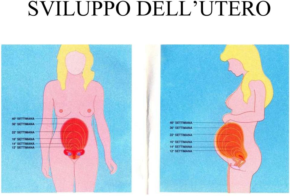 UTERO