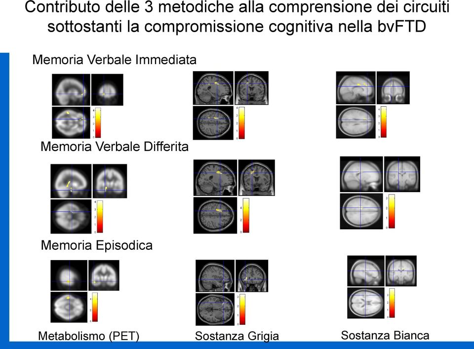 bvftd Memoria Verbale Immediata Memoria Verbale Differita