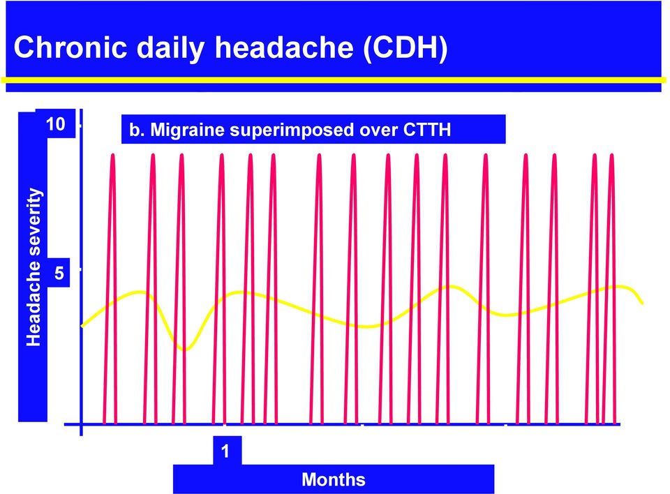 Migraine superimposed