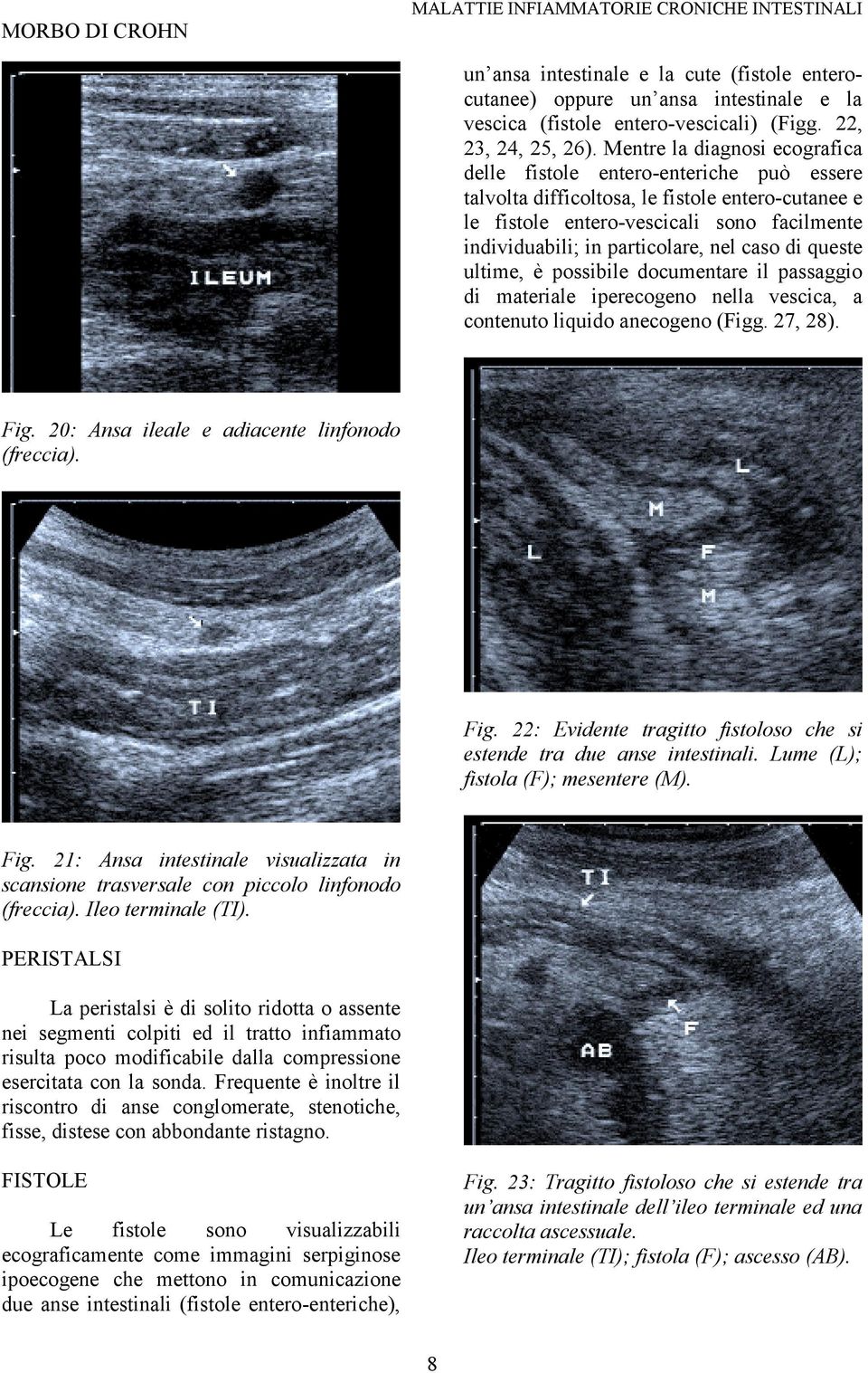 nel caso di queste ultime, è possibile documentare il passaggio di materiale iperecogeno nella vescica, a contenuto liquido anecogeno (Figg. 27, 28). Fig.