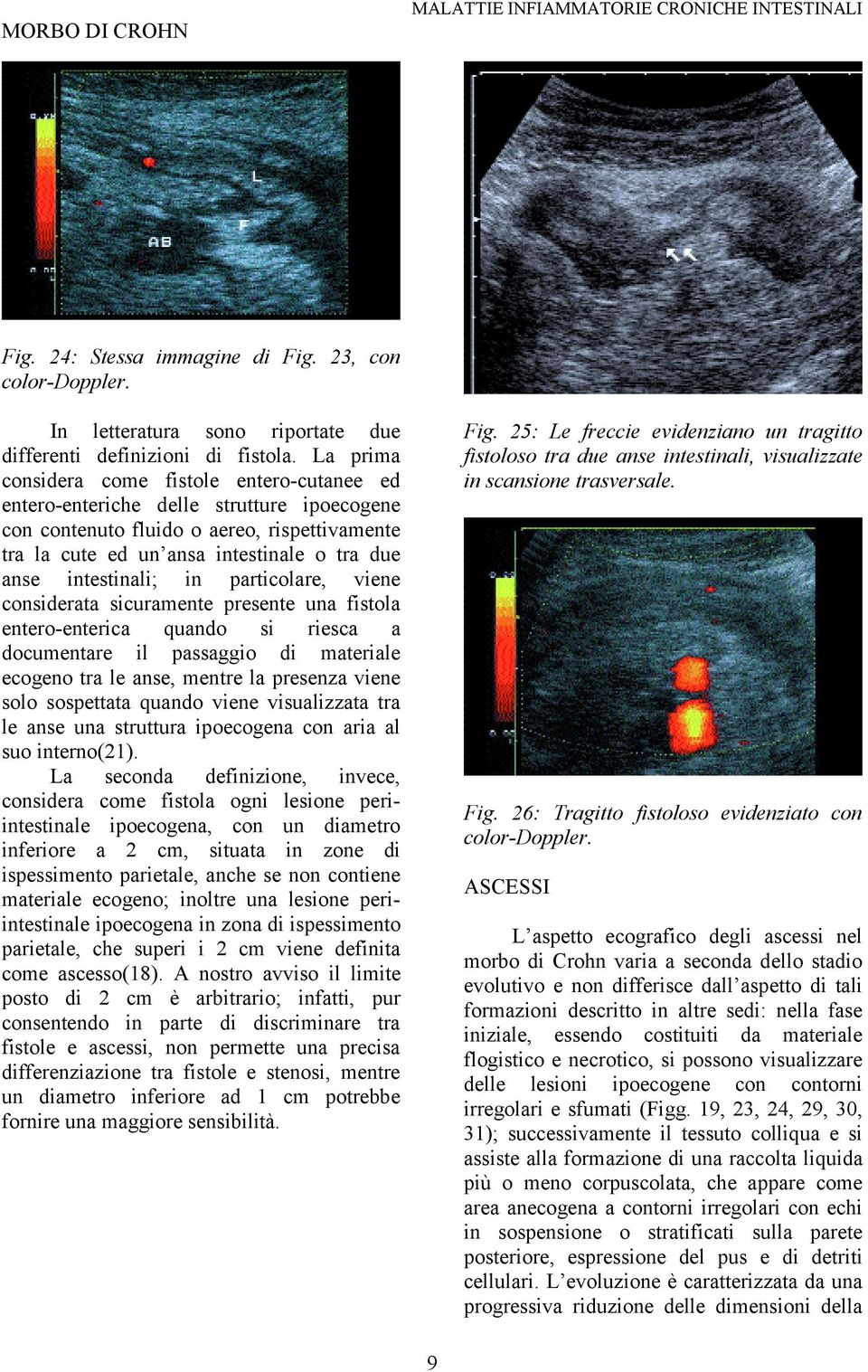 intestinali; in particolare, viene considerata sicuramente presente una fistola entero-enterica quando si riesca a documentare il passaggio di materiale ecogeno tra le anse, mentre la presenza viene