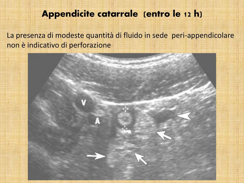 di fluido in sede