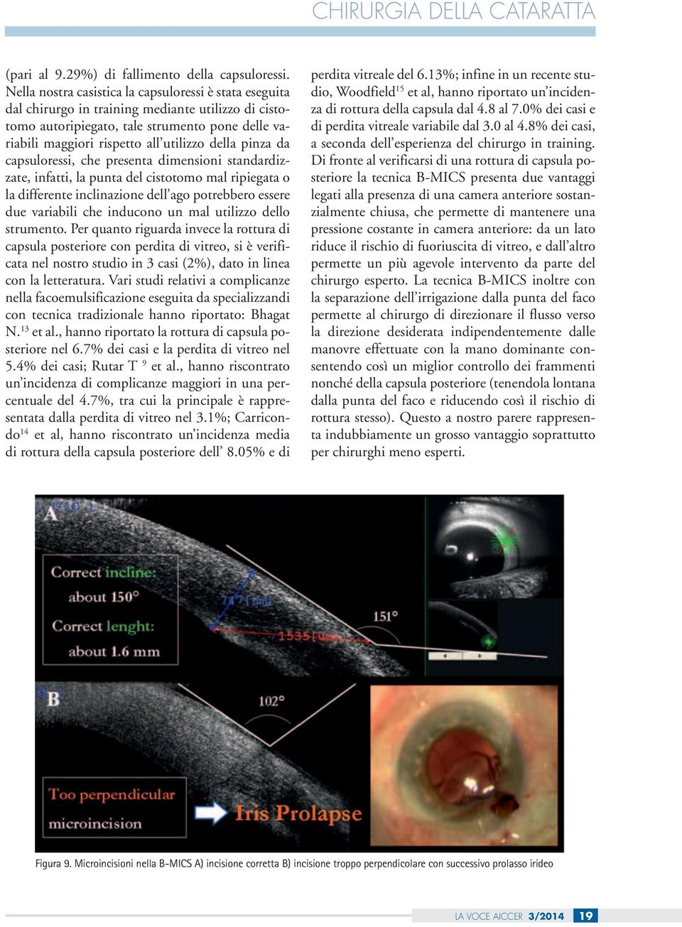 pinza da capsuloressi, che presenta dimensioni standardizzate, infatti, la punta del cistotomo mal ripiegata o la differente inclinazione dell ago potrebbero essere due variabili che inducono un mal