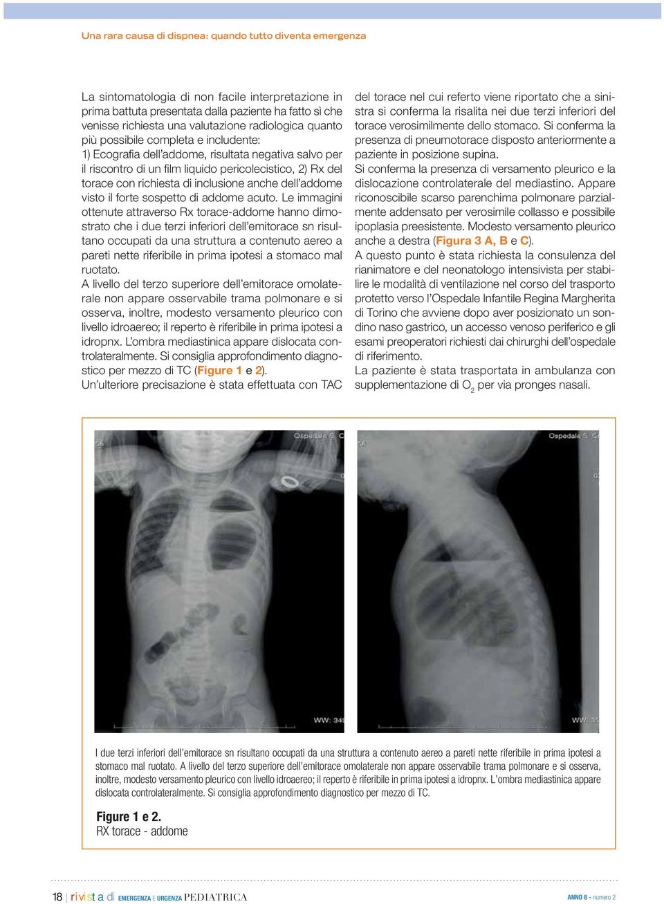 inclusione anche dell addome visto il forte sospetto di addome acuto.