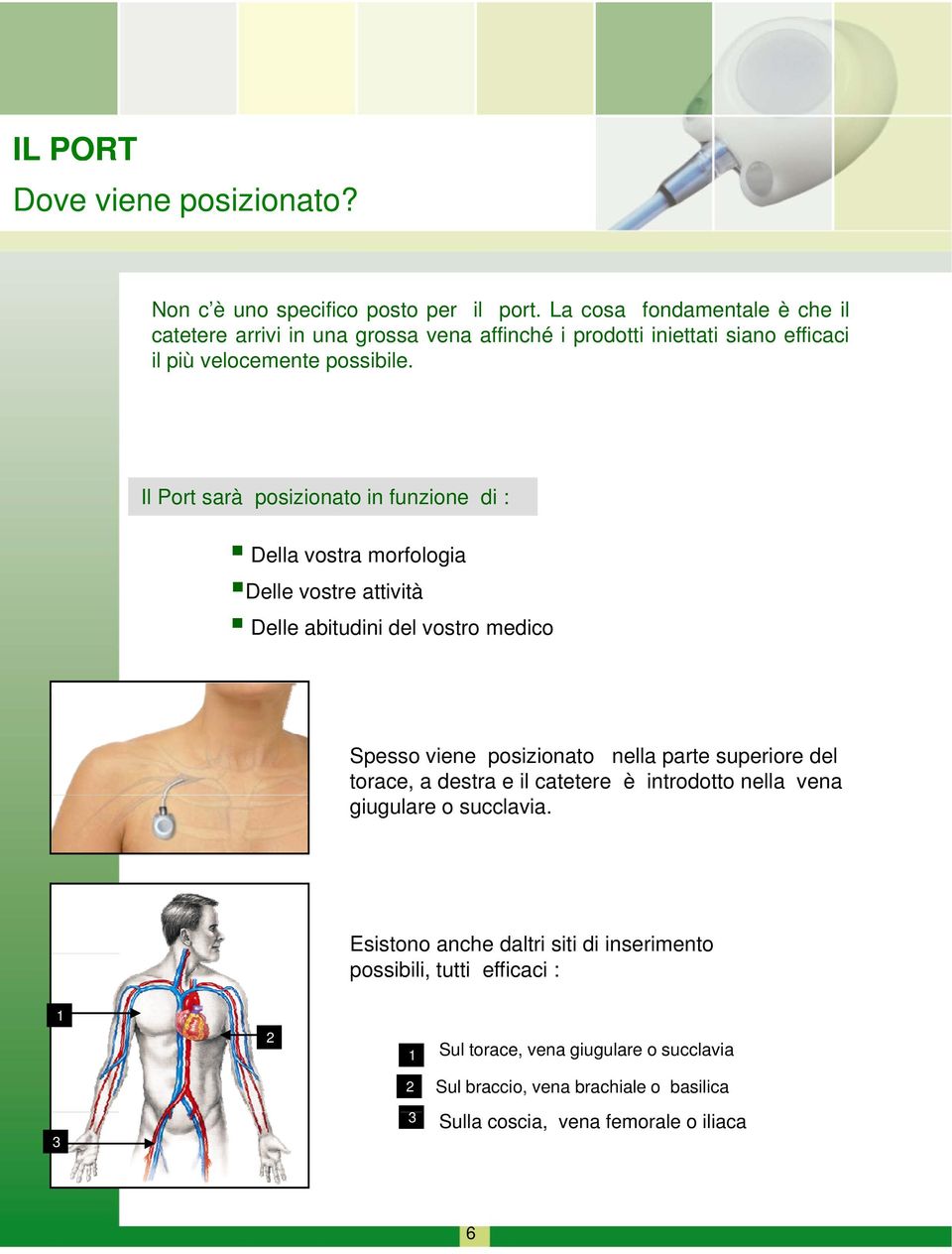 Il Port sarà posizionato in funzione di : Della vostra morfologia Delle vostre attività Delle abitudini del vostro medico Spesso viene posizionato nella parte