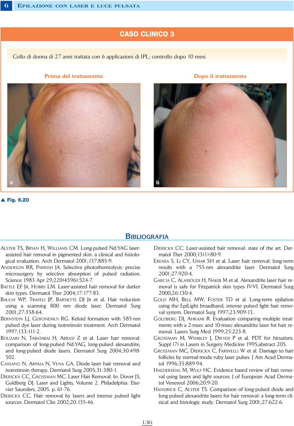 Selective photothermolysis: precise microsurgery by selective absorption of pulsed radiation. Science 1983 Apr 29;220(4596):524-7. BATTLE EF JR, HOBBS LM.