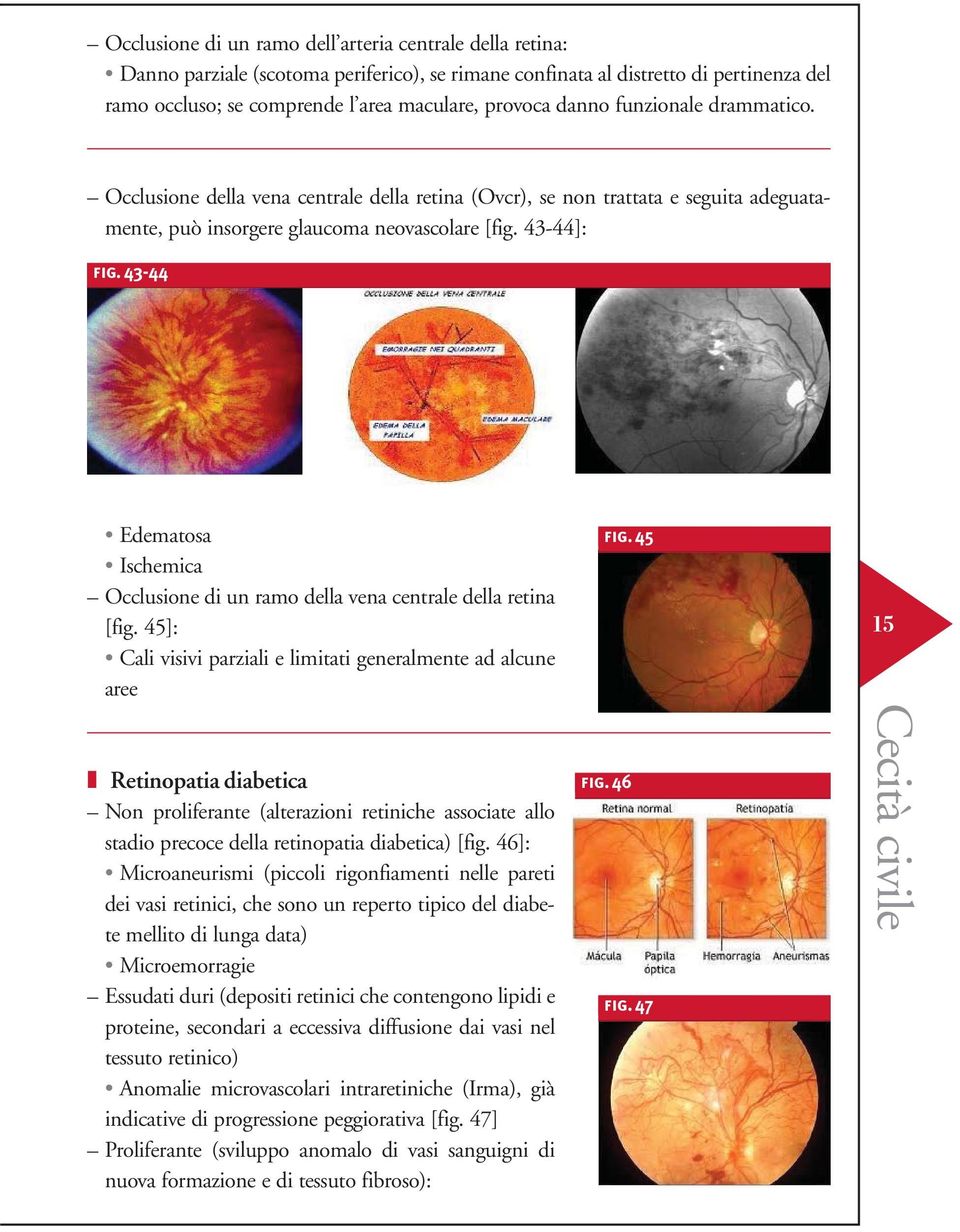 43-44 Edematosa Ischemica Occlusione di un ramo della vena centrale della retina [fig.