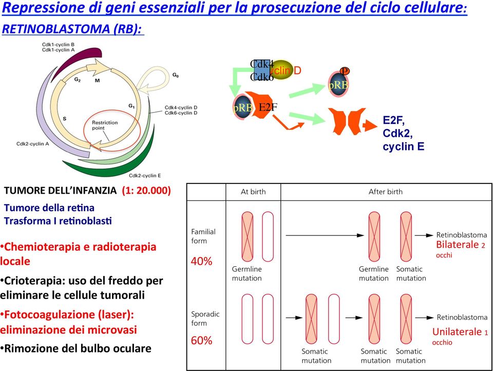 000) Tumore della re*na Trasforma I re*noblas* Chemioterapia e radioterapia locale Crioterapia: uso del freddo