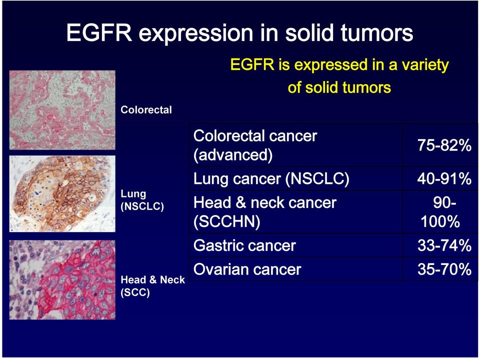 cancer (advanced) 75-82% Lung cancer (NSCLC) 40-91% Head & neck