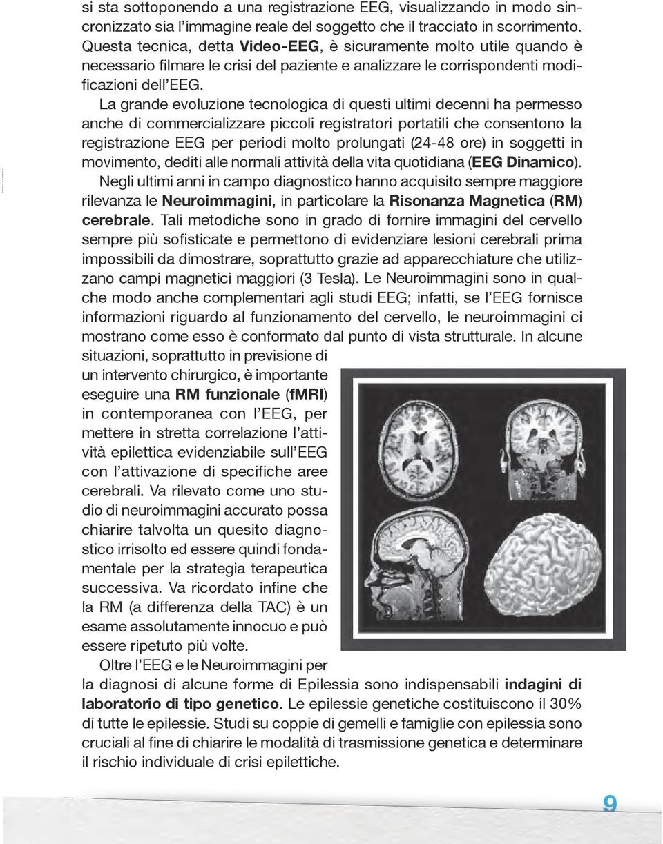 La grande evoluzione tecnologica di questi ultimi decenni ha permesso anche di commercializzare piccoli registratori portatili che consentono la registrazione EEG per periodi molto prolungati (24-48