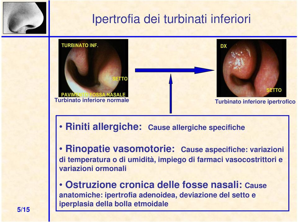 temperatura o di umidità, impiego di farmaci vasocostrittori e variazioni ormonali 5/15 Ostruzione