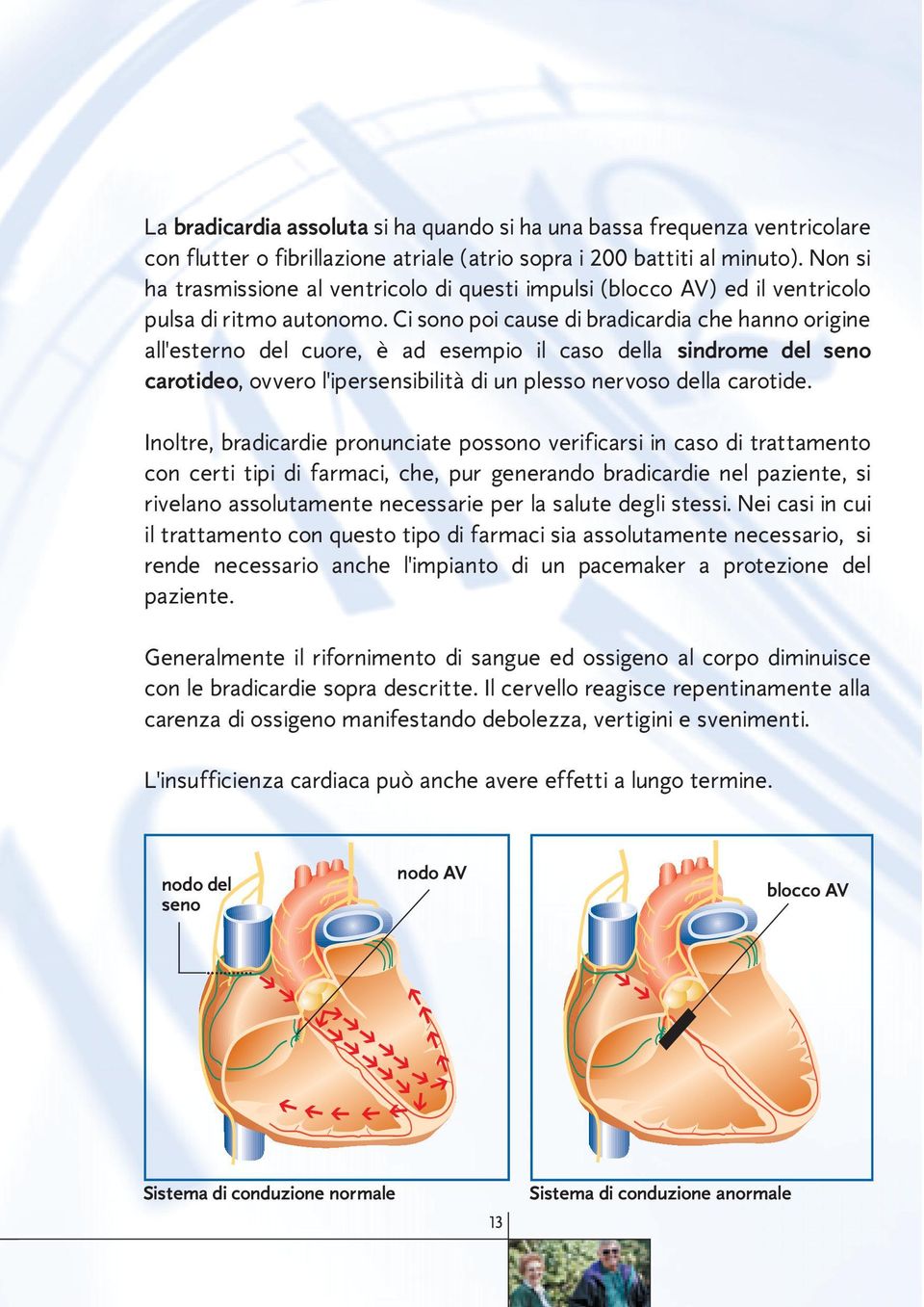 Ci sono poi cause di bradicardia che hanno origine all'esterno del cuore, è ad esempio il caso della sindrome del seno carotideo, ovvero l'ipersensibilità di un plesso nervoso della carotide.