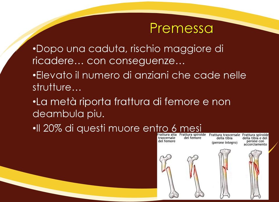 che cade nelle strutture La metà riporta frattura di