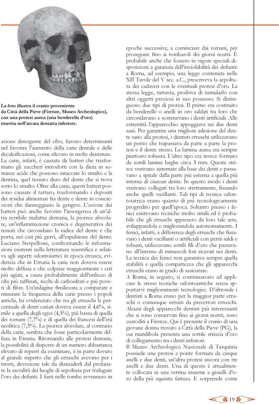 La carie, infatti, è causata da batteri che trasformano gli zuccheri introdotti con la dieta in sostanze acide che possono intaccare lo smalto e la dentina, quel tessuto duro del dente che si trova