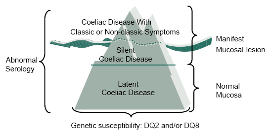 MANIFESTAZIONI CLINIHE DELLA MALATTIA CELIACA Le manifestazioni cliniche della malattia celiaca sono estremamente variabili.