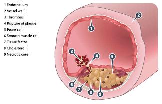 ANTICOAGULANTI Turpie AGG, Esmon C, Thromb