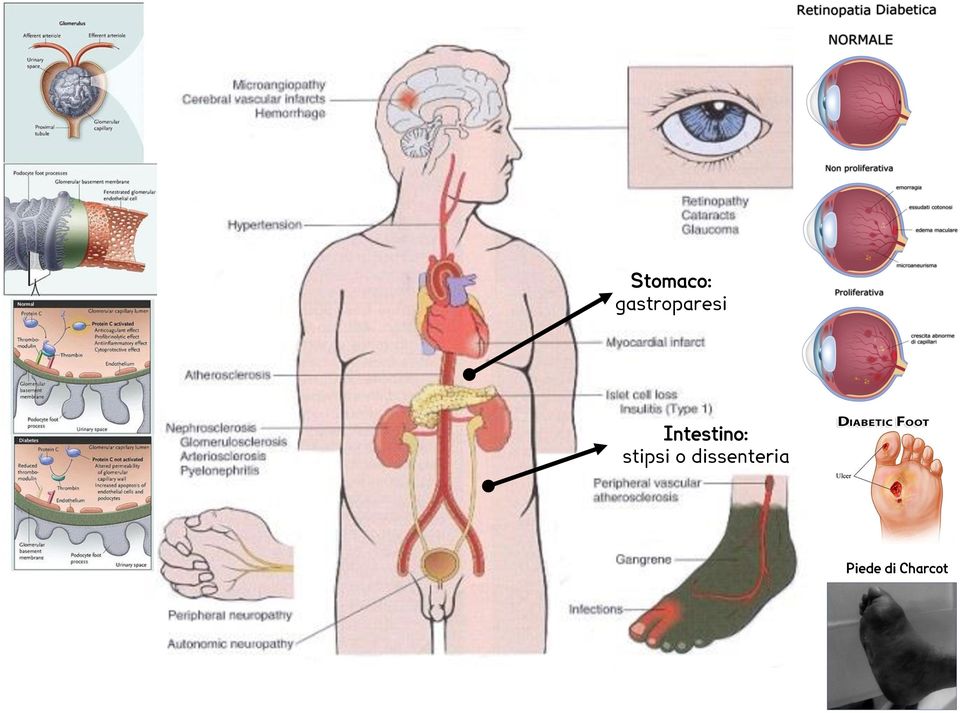 Intestino: stipsi